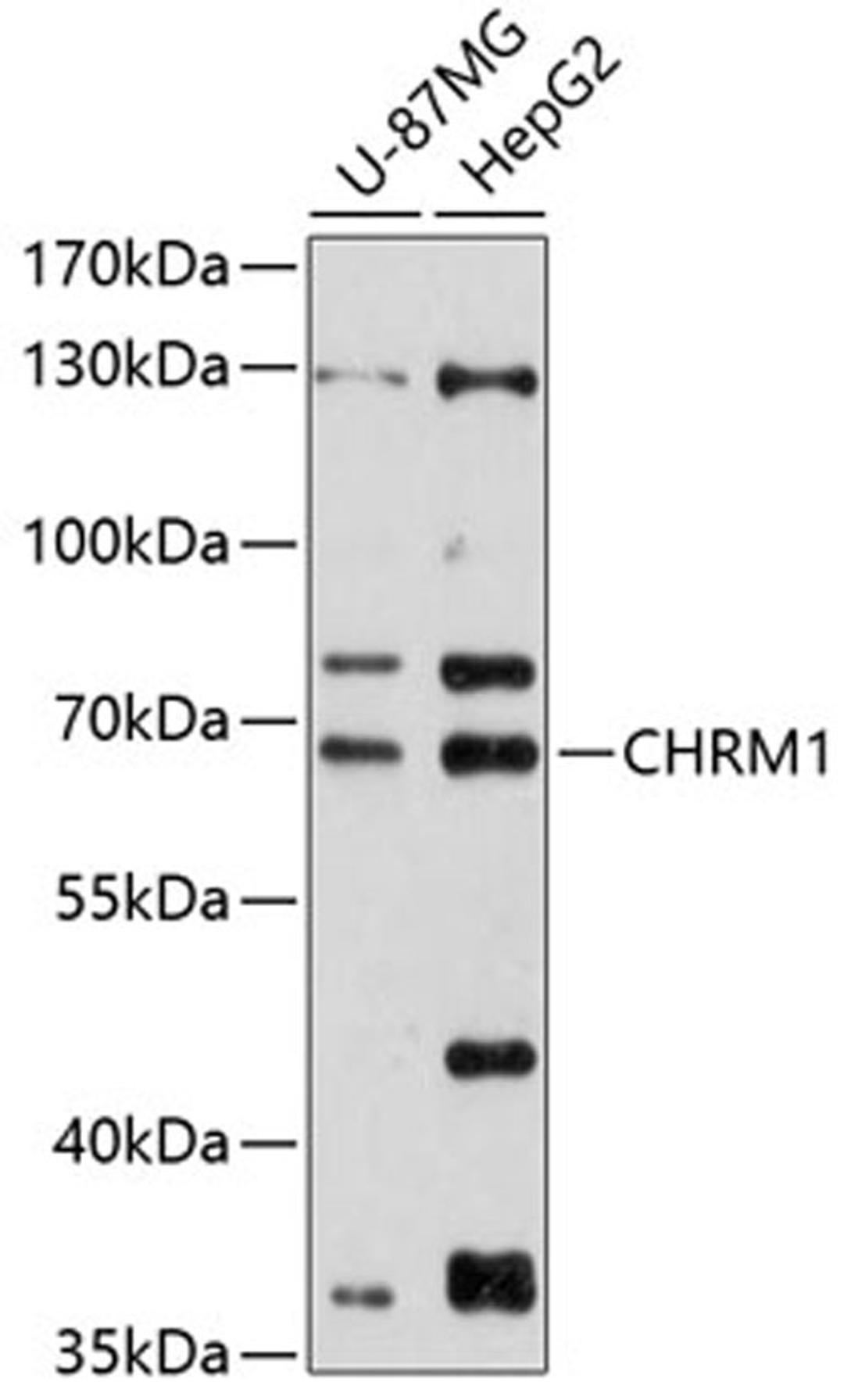 Western blot - CHRM1 antibody (A12323)