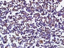 Immunohistochemical staining of mouse embryo liver tissue using PLAG1 antibody.