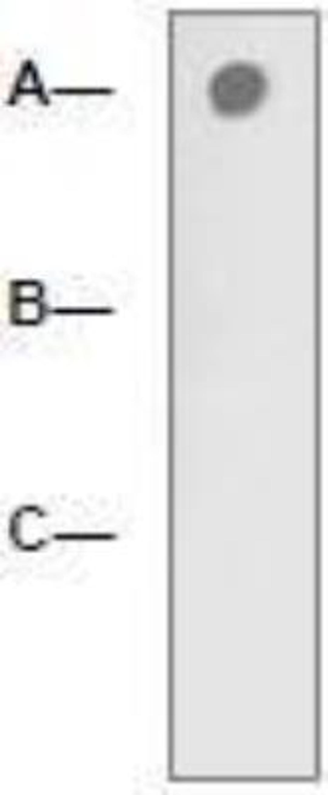 Dot Blot: LRP-5 [p Thr1492] Antibody [NBP1-74653] - 1 mg peptide was blot onto NC membrane (A-LRP-5 (pT1492); B-LRP5 (Nonphospho); C: Nonrelated Phosphopeptide) was blotted by Rabbit anti-LRP-5 pT1479) a 1:2000