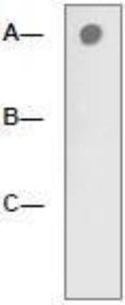 Dot Blot: LRP-5 [p Thr1492] Antibody [NBP1-74653] - 1 mg peptide was blot onto NC membrane (A-LRP-5 (pT1492); B-LRP5 (Nonphospho); C: Nonrelated Phosphopeptide) was blotted by Rabbit anti-LRP-5 pT1479) a 1:2000