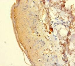 Immunohistochemistry of paraffin-embedded human adrenal gland tissue using CSB-PA010887LA01HU at dilution of 1:100