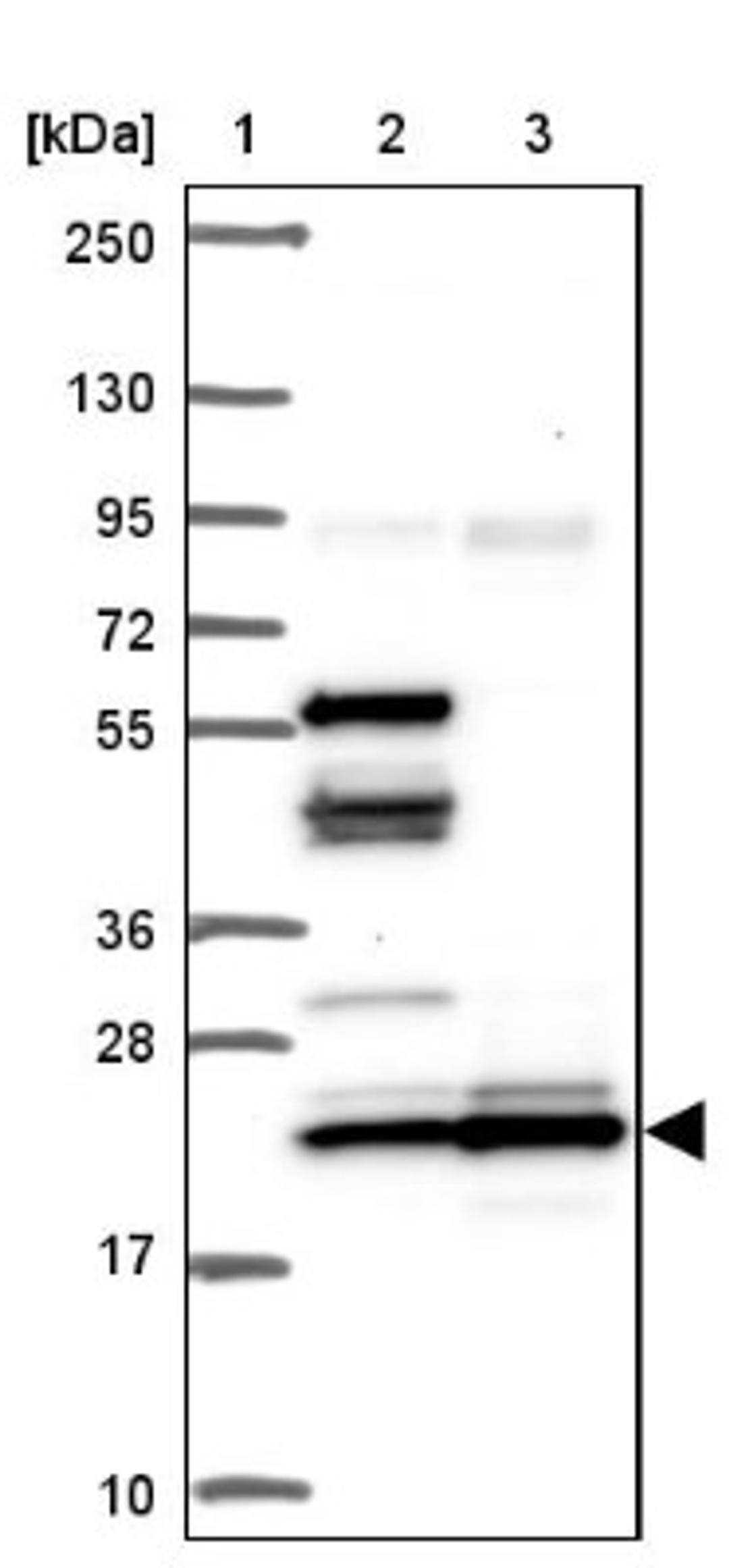 Western Blot: RPL24/RLP24 Antibody [NBP2-38971] - Lane 1: Marker [kDa] 250, 130, 95, 72, 55, 36, 28, 17, 10<br/>Lane 2: RT-4<br/>Lane 3: U-251 MG