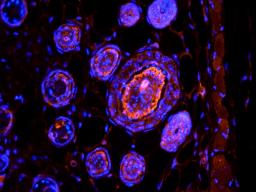 Immunofluorescence analysis of mouse skin tissue using anti-TGF beta 1 (primary antibody at 1:500)