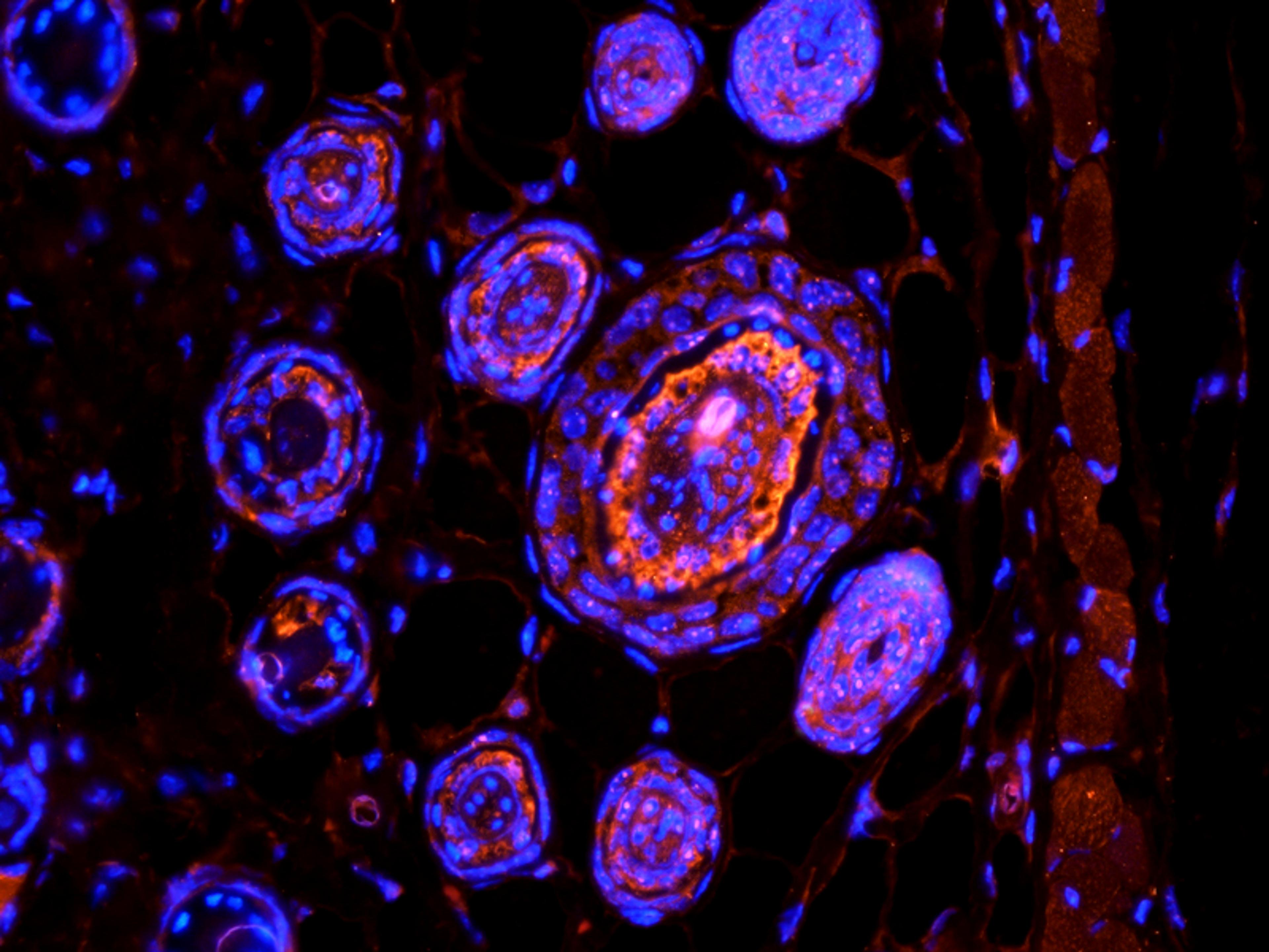 Immunofluorescence analysis of mouse skin tissue using anti-TGF beta 1 (primary antibody at 1:500)