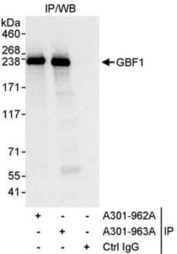 Detection of human GBF1 by western blot of immunoprecipitates.