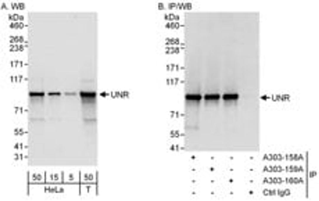 Detection of human UNR by western blot and immunoprecipitation.