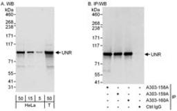 Detection of human UNR by western blot and immunoprecipitation.