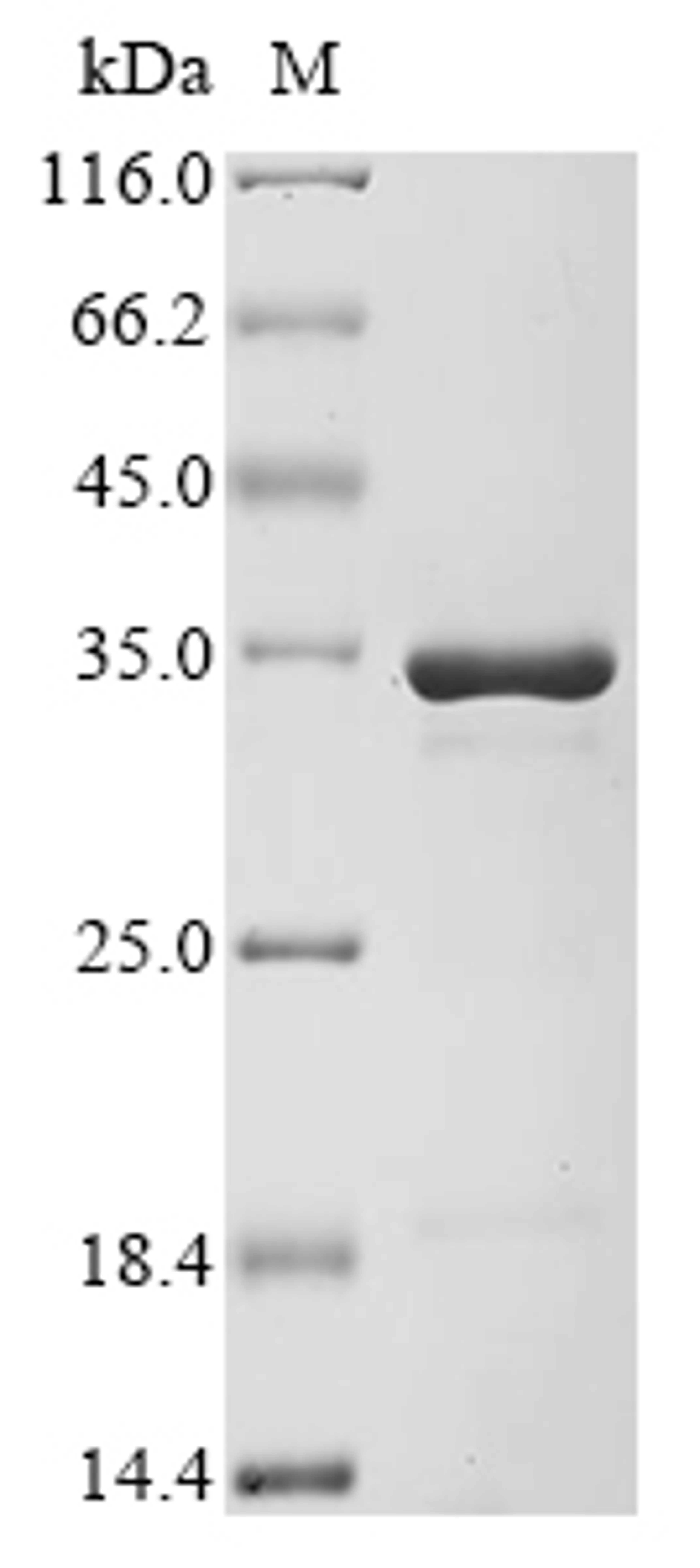 (Tris-Glycine gel) Discontinuous SDS-PAGE (reduced) with 5% enrichment gel and 15% separation gel.
