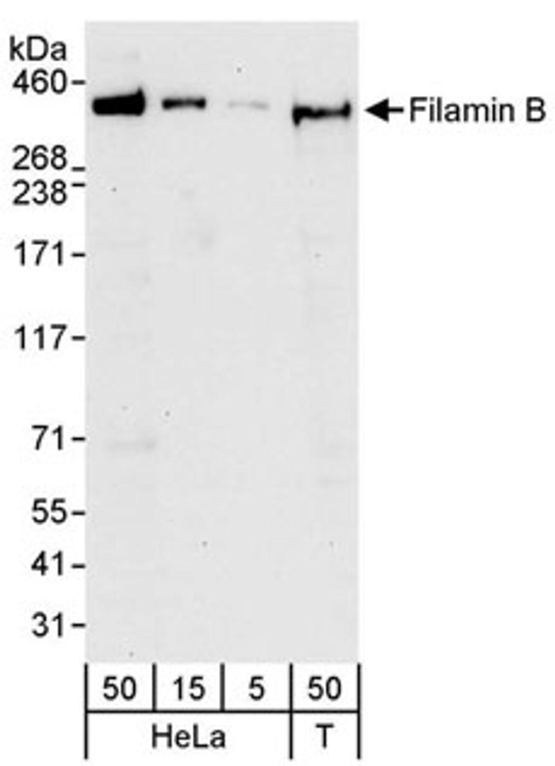 Detection of human Filamin B by western blot.