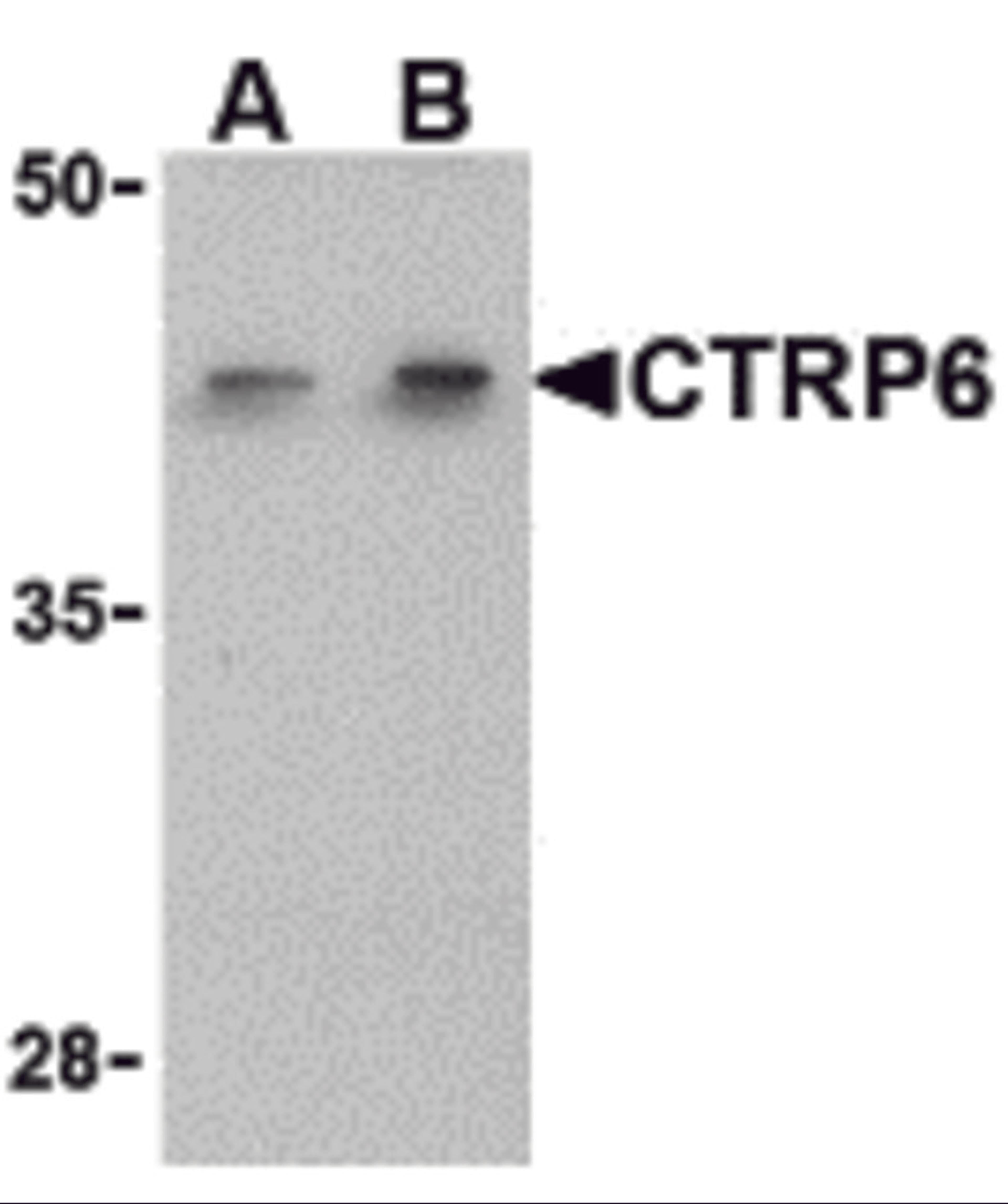 Western blot analysis of CTRP6 in HeLa cell lysate with CTRP6 antibody at (A) 1 and (B) 2 &#956;g/mL.