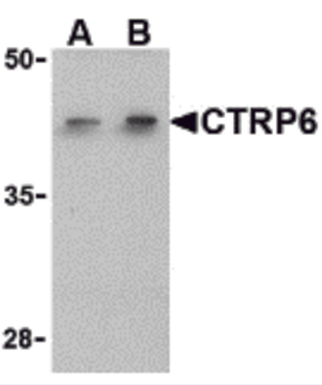 Western blot analysis of CTRP6 in HeLa cell lysate with CTRP6 antibody at (A) 1 and (B) 2 μg/mL.