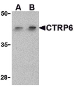 Western blot analysis of CTRP6 in HeLa cell lysate with CTRP6 antibody at (A) 1 and (B) 2 μg/mL.