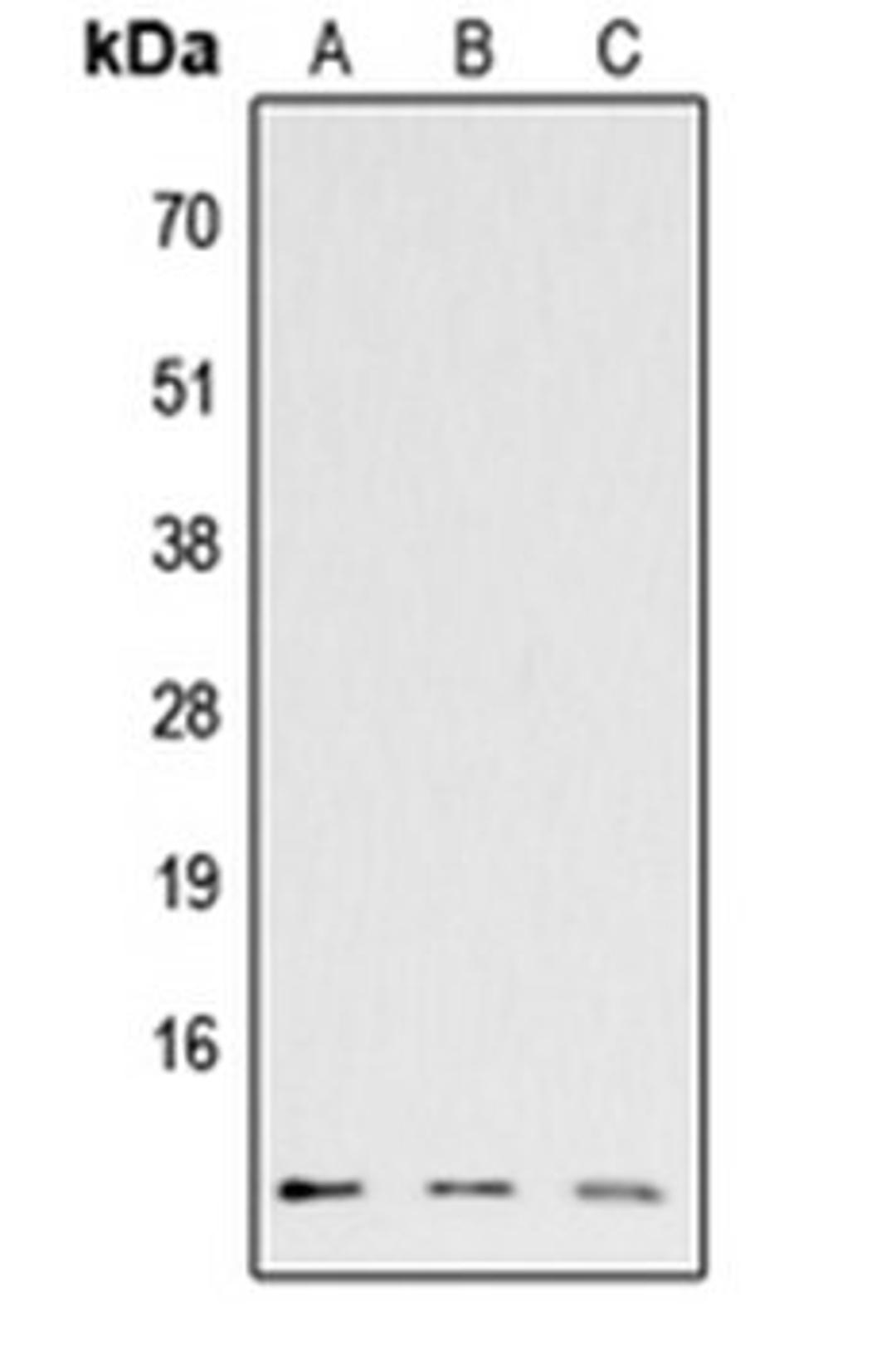 Western blot analysis of HEK293T (Lane 1), Raw264.7 (Lane 2), H9C2 (Lane 3) whole cell lysates using CCL26 antibody