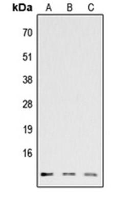 Western blot analysis of HEK293T (Lane 1), Raw264.7 (Lane 2), H9C2 (Lane 3) whole cell lysates using CCL26 antibody