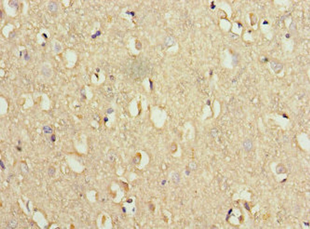 Immunohistochemistry of paraffin-embedded human brain tissue using CSB-PA845154HA01HU at dilution of 1:100
