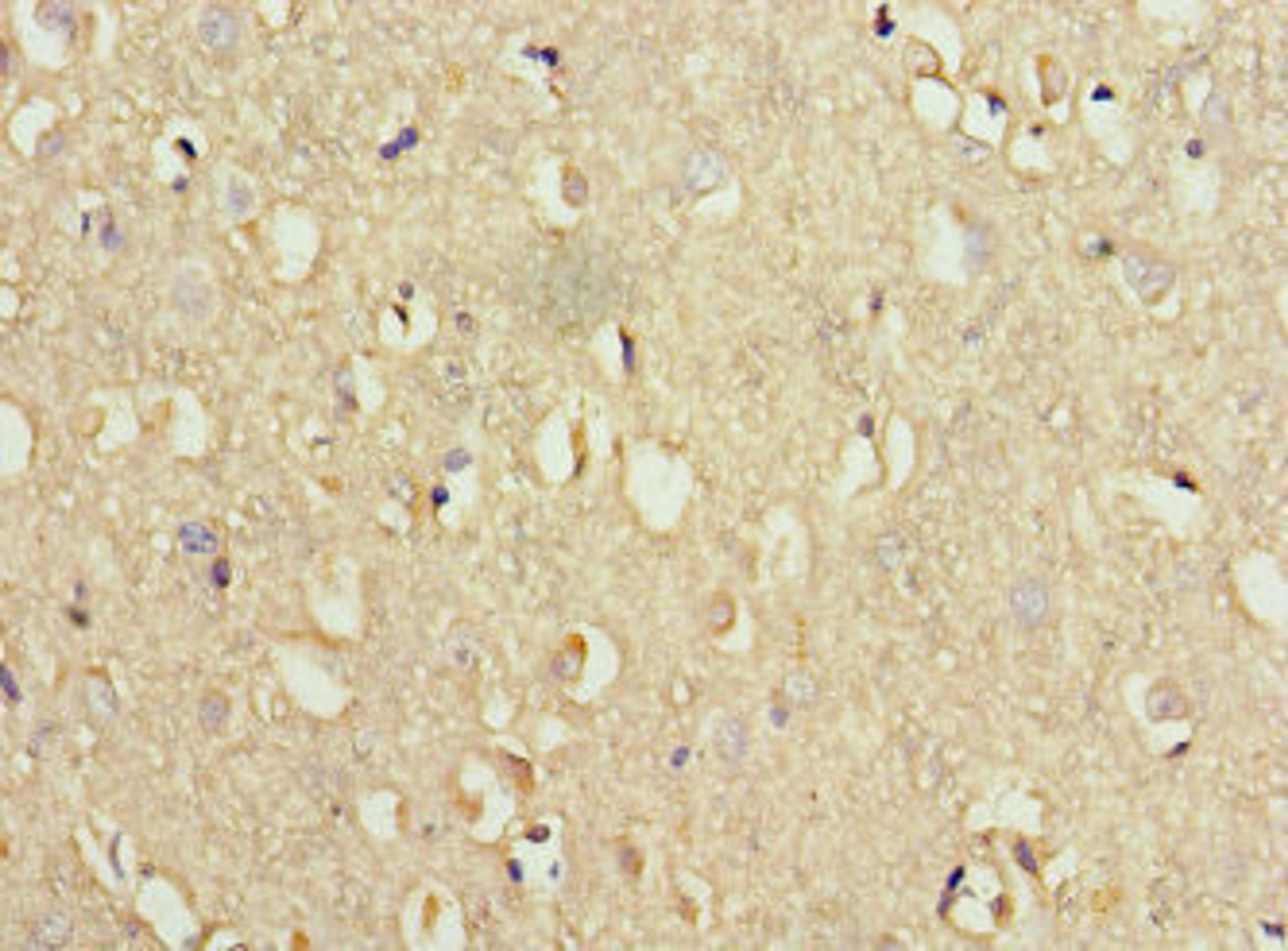 Immunohistochemistry of paraffin-embedded human brain tissue using CSB-PA845154HA01HU at dilution of 1:100