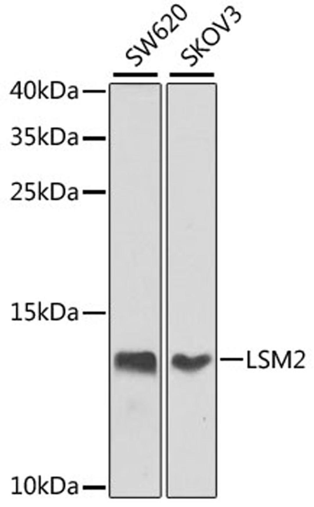 Western blot - LSM2 antibody (A7988)