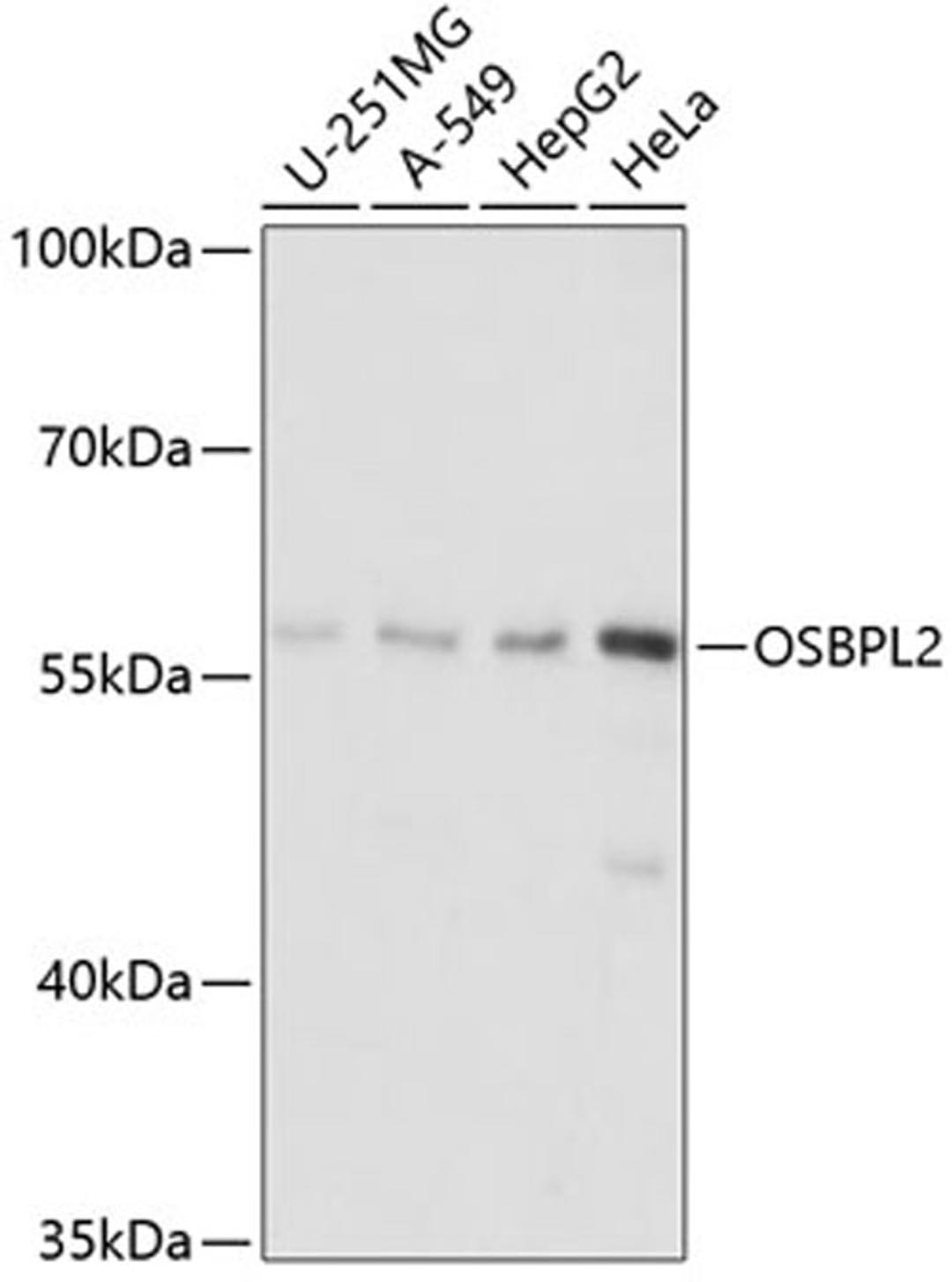 Western blot - OSBPL2 antibody (A14199)