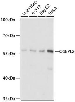 Western blot - OSBPL2 antibody (A14199)