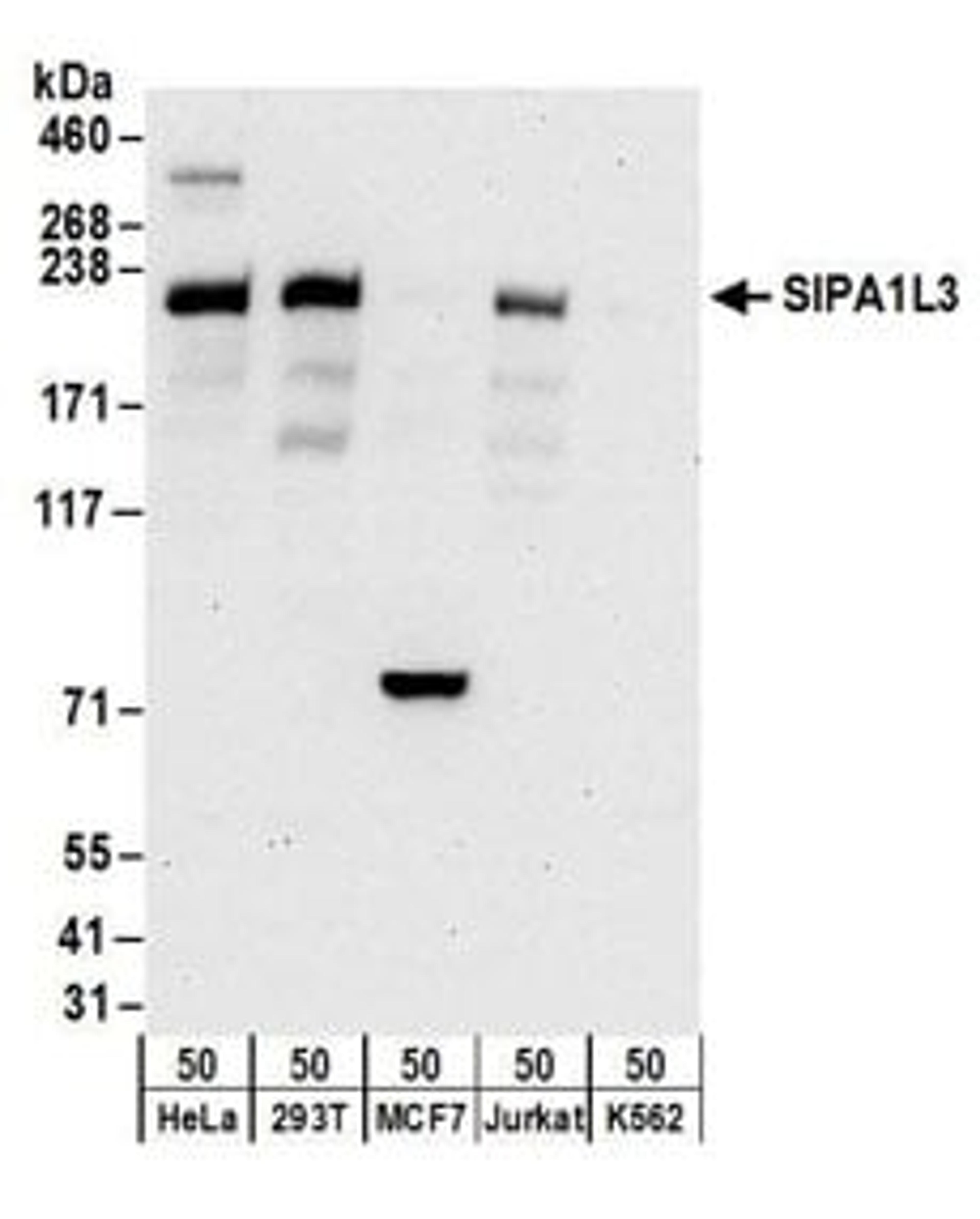 Detection of human SIPA1L3 by western blot.