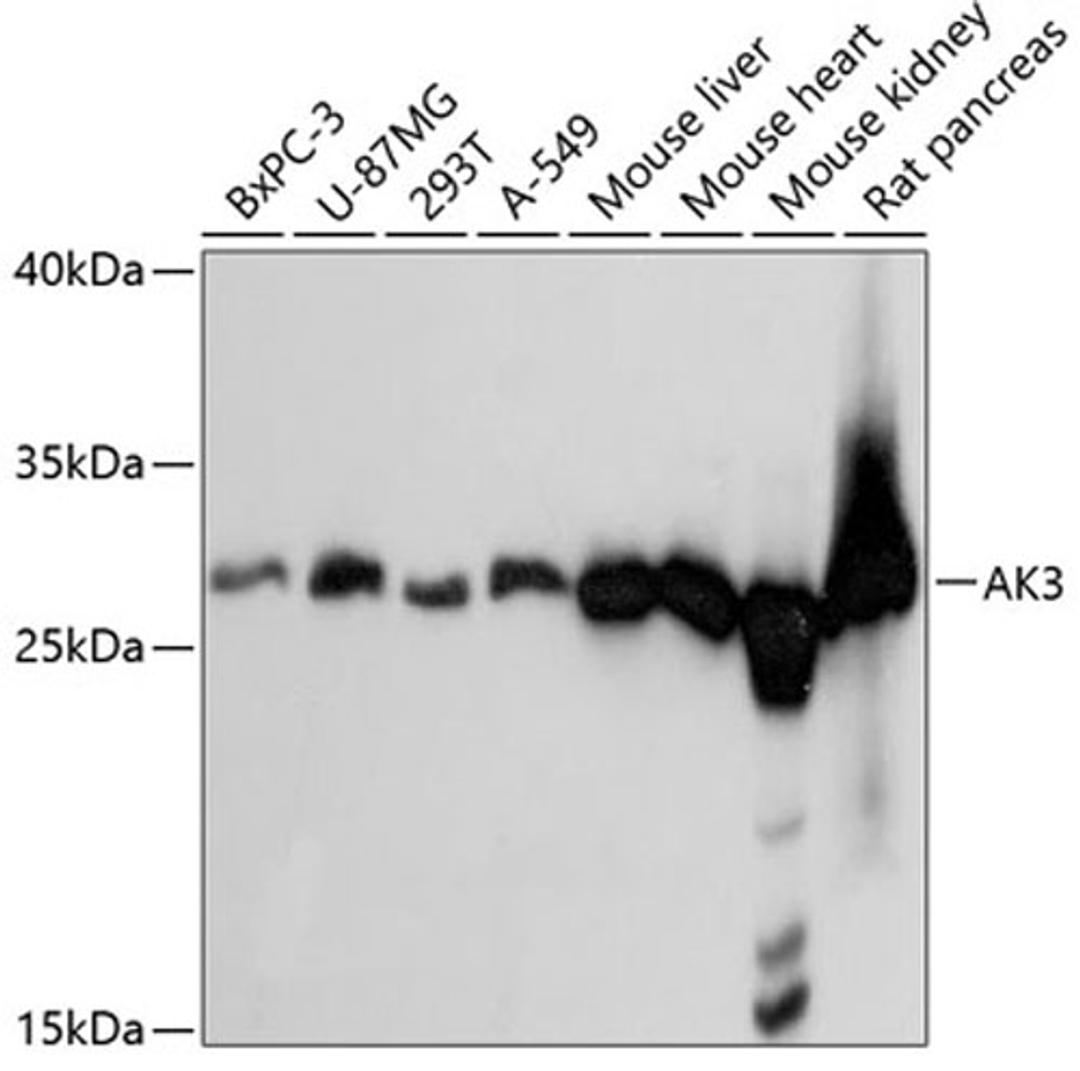 Western blot - AK3 antibody (A4694)