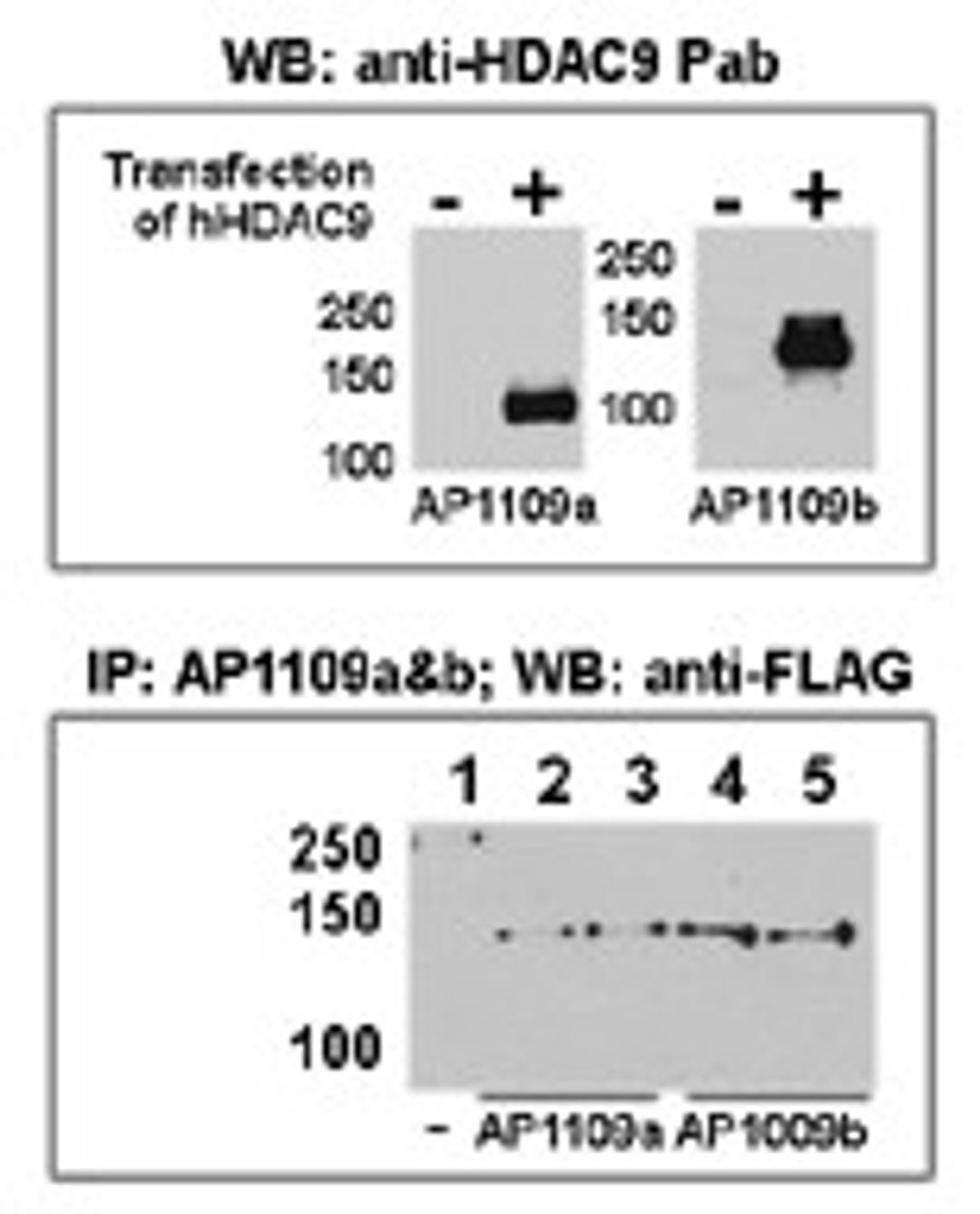 Both anti-HDAC9 N-term and C-term Pab were tested by WB and IP-WB using HeLa and HeLa-HDAC9 transfected cells. Top figure shows both Pab specifically detect HDAC9 in HeLa-HDAC9 transfected cell but not HeLa alone. Bottom figure shows that both Pab can imm