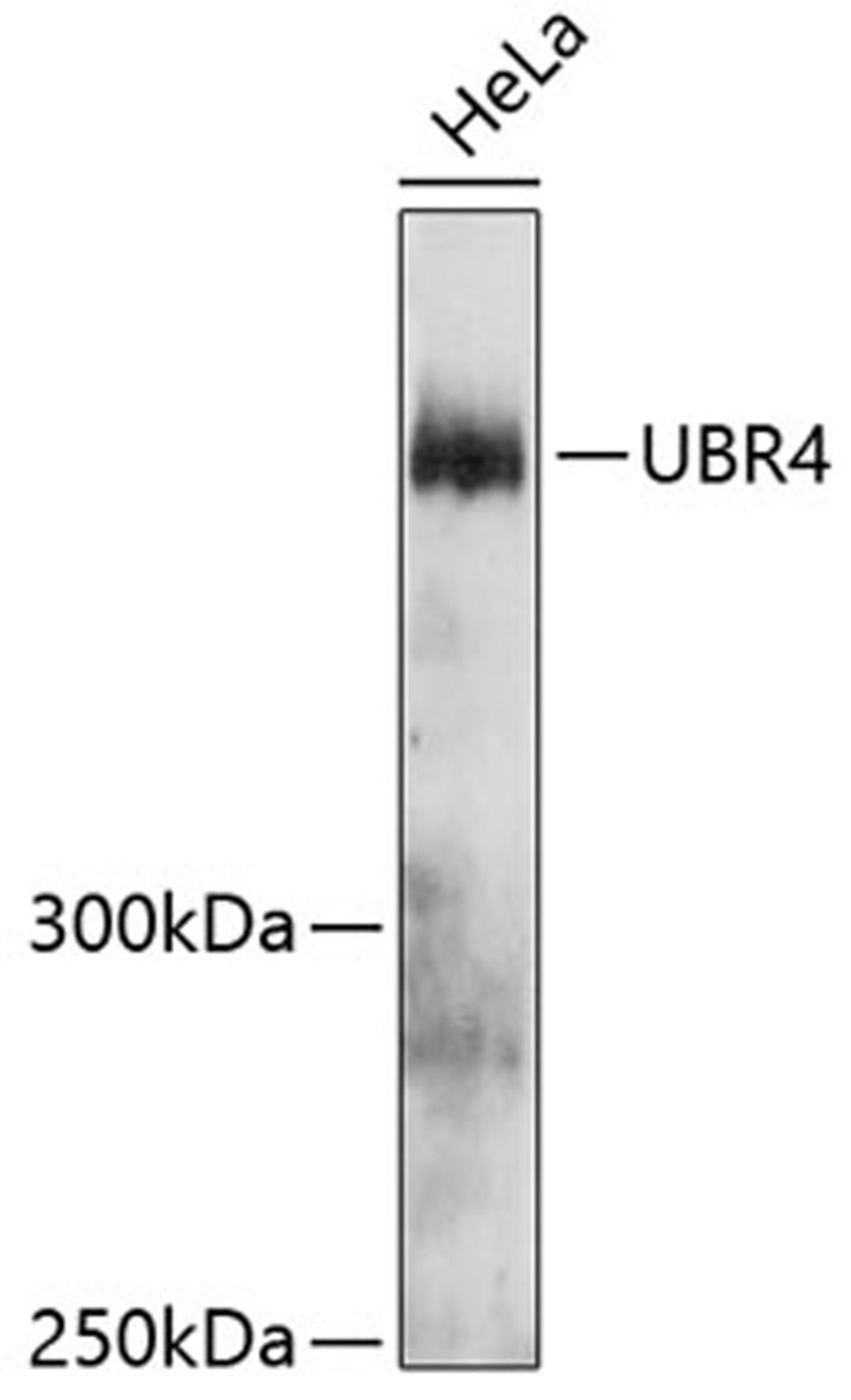 Western blot - UBR4 antibody (A12193)