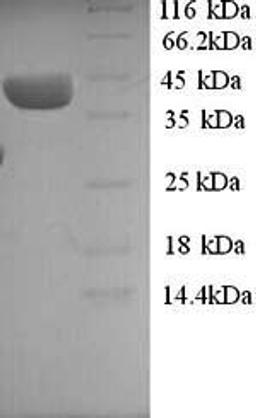 (Tris-Glycine gel) Discontinuous SDS-PAGE (reduced) with 5% enrichment gel and 15% separation gel.