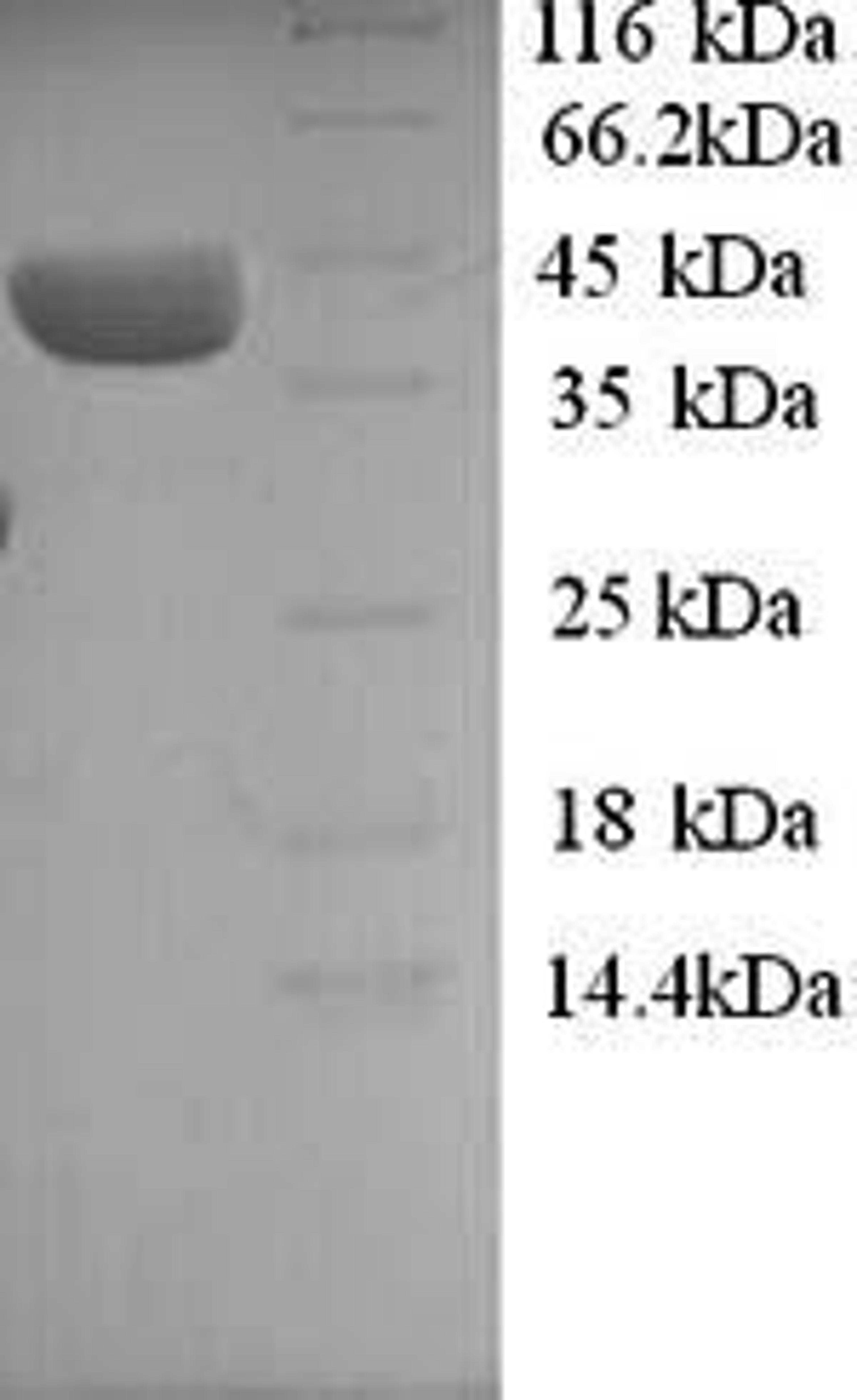 (Tris-Glycine gel) Discontinuous SDS-PAGE (reduced) with 5% enrichment gel and 15% separation gel.