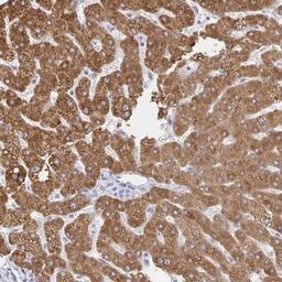 Immunohistochemistry: ZNF100 Antibody [NBP2-32429] - Staining of human liver shows strong cytoplasmic positivity in hepatocytes.