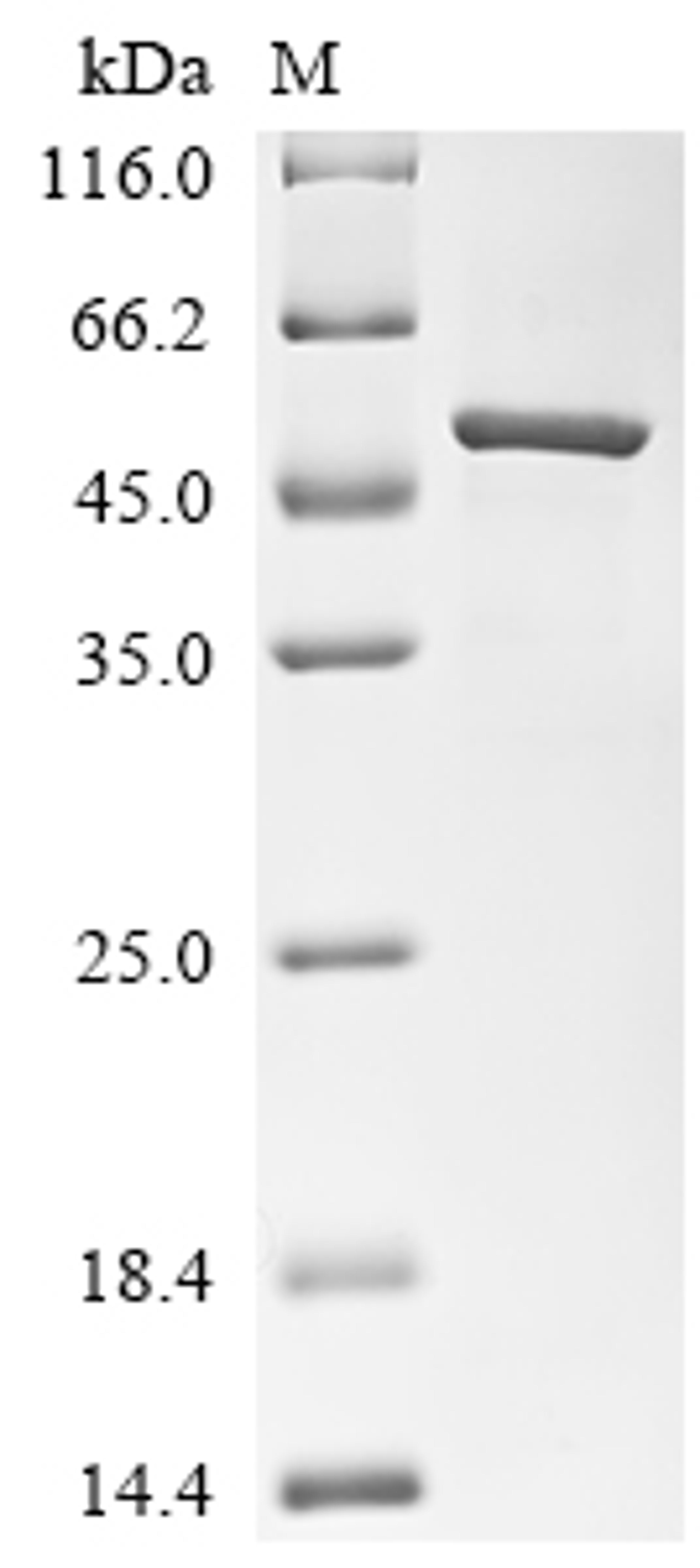 (Tris-Glycine gel) Discontinuous SDS-PAGE (reduced) with 5% enrichment gel and 15% separation gel.