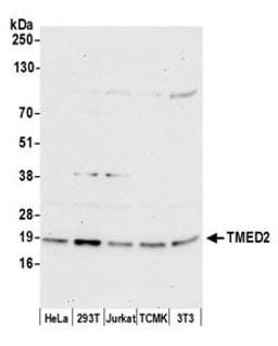 Detection of human and mouse TMED2 by western blot.