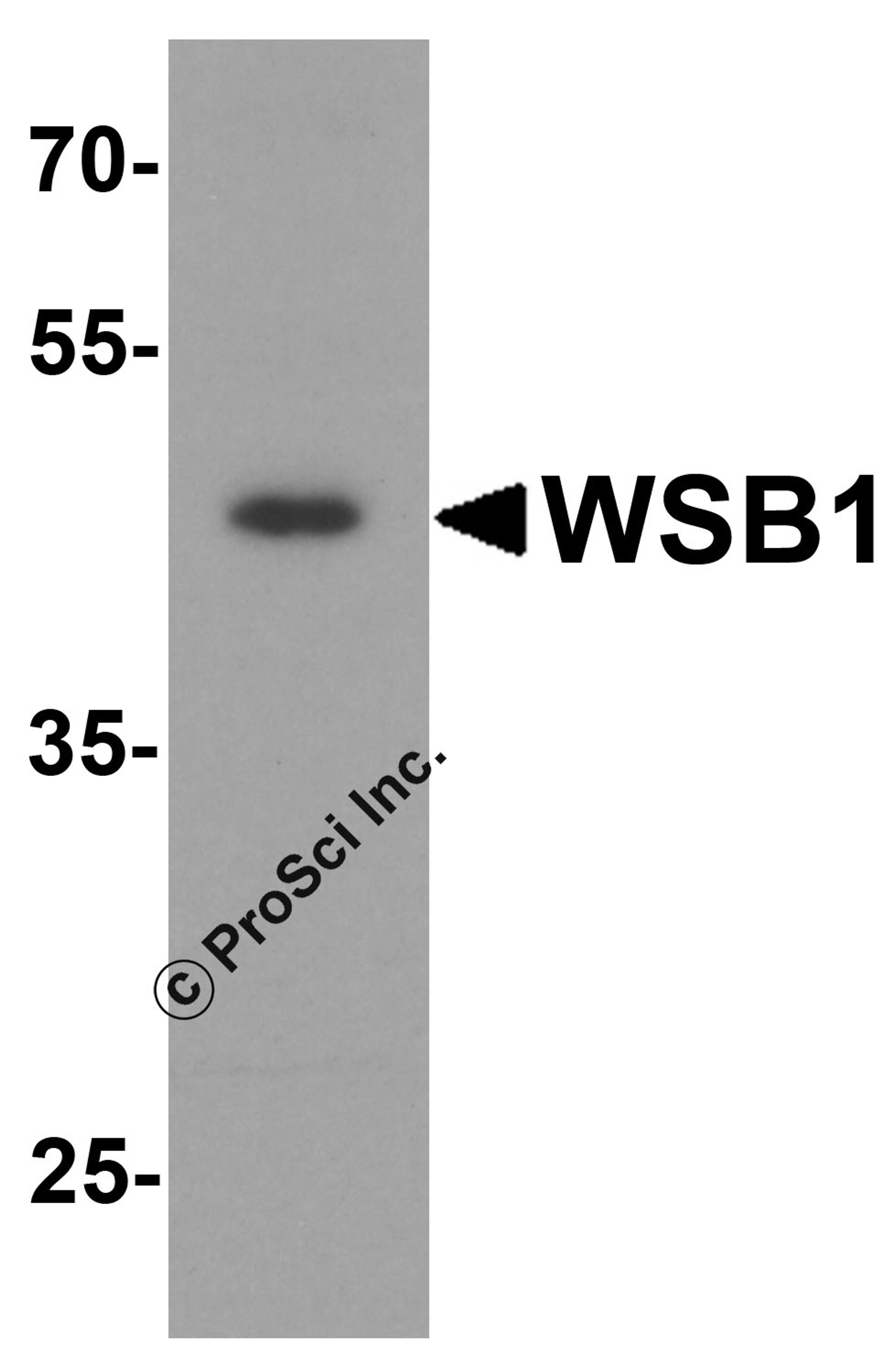 Western blot analysis of WSB1 in human colon tissue lysate with WSB1 antibody at 1 &#956;g/ml.