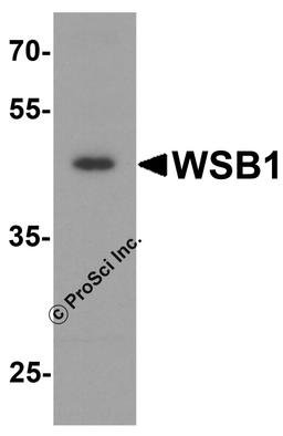 Western blot analysis of WSB1 in human colon tissue lysate with WSB1 antibody at 1 μg/ml.