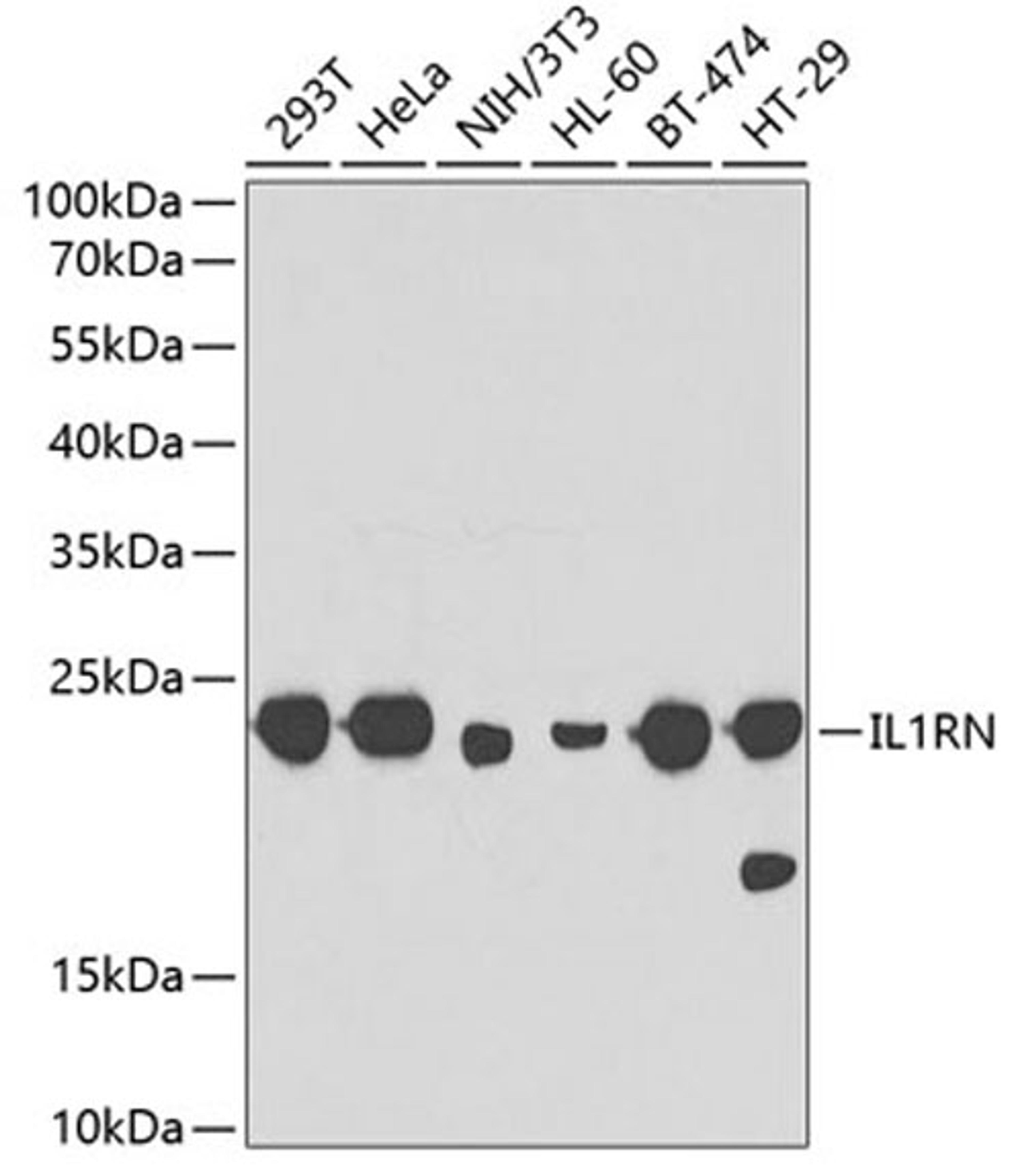 Western blot - IL1RN antibody (A2088)