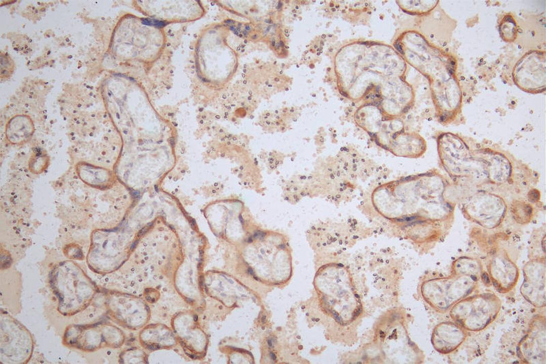 IHC image of CSB-RA111920A0HU diluted at 1:100 and staining in paraffin-embedded human placenta tissue performed on a Leica BondTM system. After dewaxing and hydration, antigen retrieval was mediated by high pressure in a citrate buffer (pH 6.0). Section was blocked with 10% normal goat serum 30min at RT. Then primary antibody (1% BSA) was incubated at 4°C overnight. The primary is detected by a Goat anti-rabbit polymer IgG labeled by HRP and visualized using 0.37% DAB.
