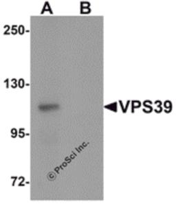 Western blot analysis of VPS39 in rat liver tissue lysate with VPS39 antibody at 0.5 μg/mL in (A) the absence and (B) the presence of blocking peptide.