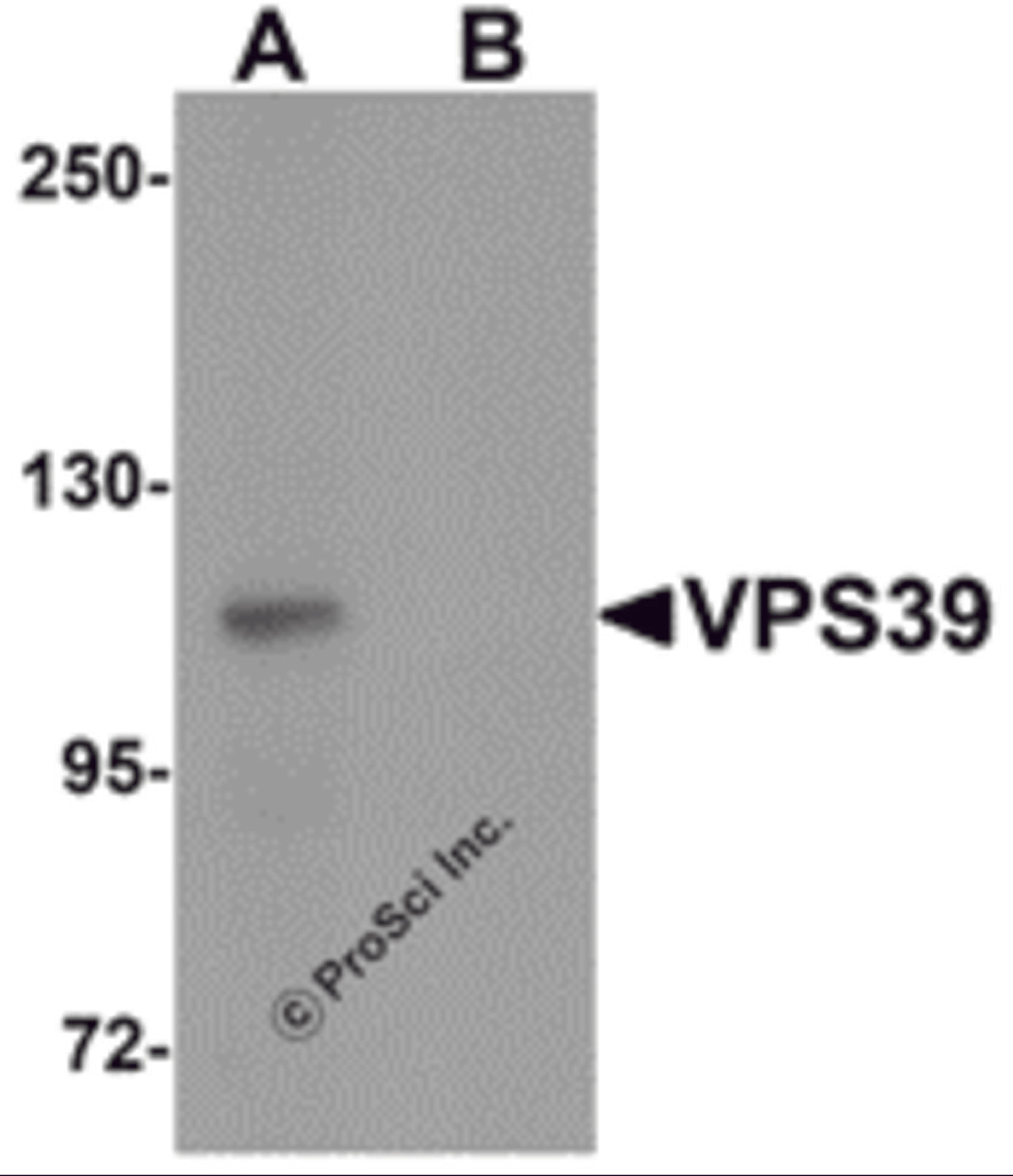 Western blot analysis of VPS39 in rat liver tissue lysate with VPS39 antibody at 0.5 μg/mL in (A) the absence and (B) the presence of blocking peptide.