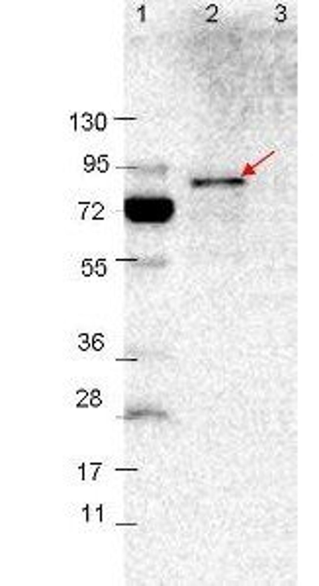 Western blot analysis of Lane 1: Molecular weight markers. Lane 2: MBP-VlsE fusion protein (arrow; expected MW: 78.8 kDa). Lane 3: MBP alone. Protein was run on a 4-20% gel, then transferred to 0.45 um nitrocellulose using VlsE antibody