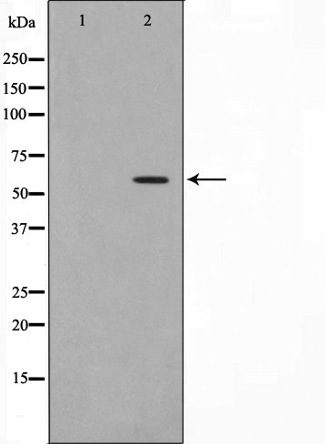 Western blot analysis of A549 cell lysate using HBP1 (Phospho-Ser402) antibody