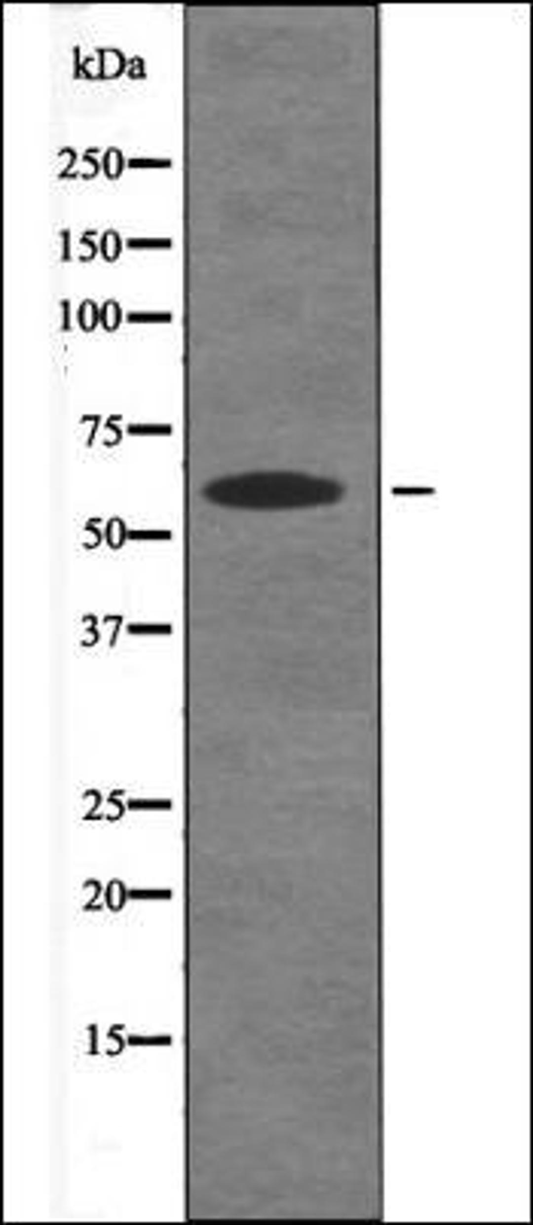 Western blot analysis of UV treated K562 whole cell lysates using DYRK2/4 -Phospho-Tyr386/268- antibody