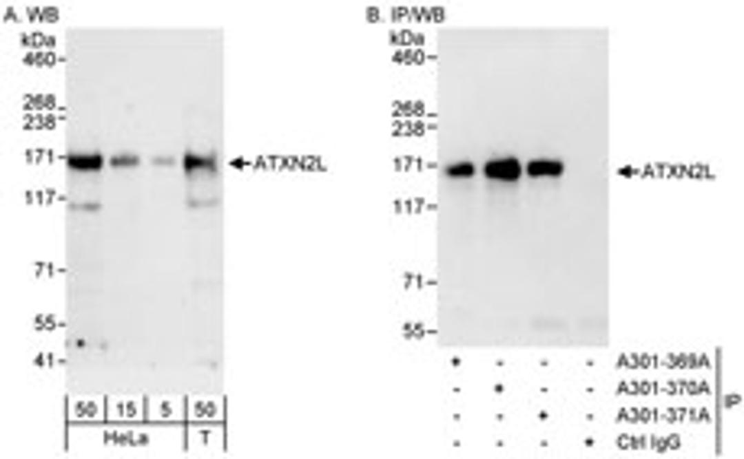 Detection of human ATXN2L by western blot and immunoprecipitation.