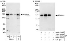 Detection of human ATXN2L by western blot and immunoprecipitation.