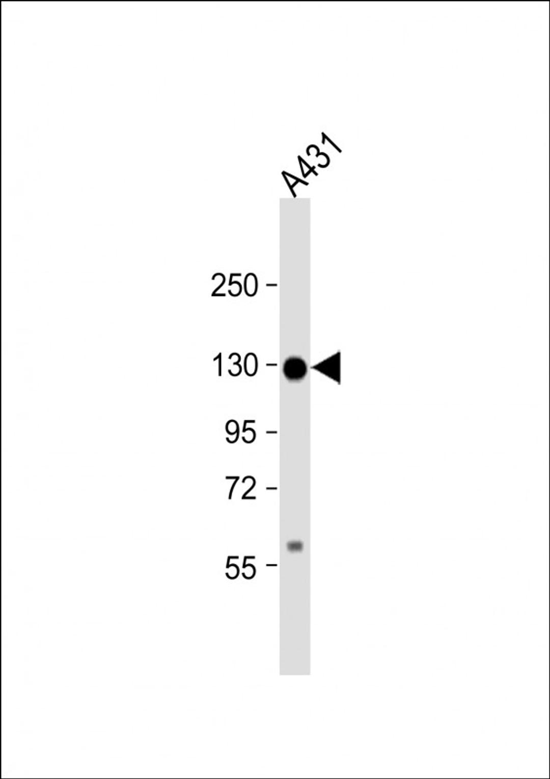 Western Blot at 1:1000 dilution + A431 whole cell lysate Lysates/proteins at 20 ug per lane.