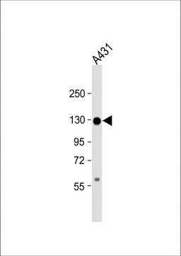 Western Blot at 1:1000 dilution + A431 whole cell lysate Lysates/proteins at 20 ug per lane.