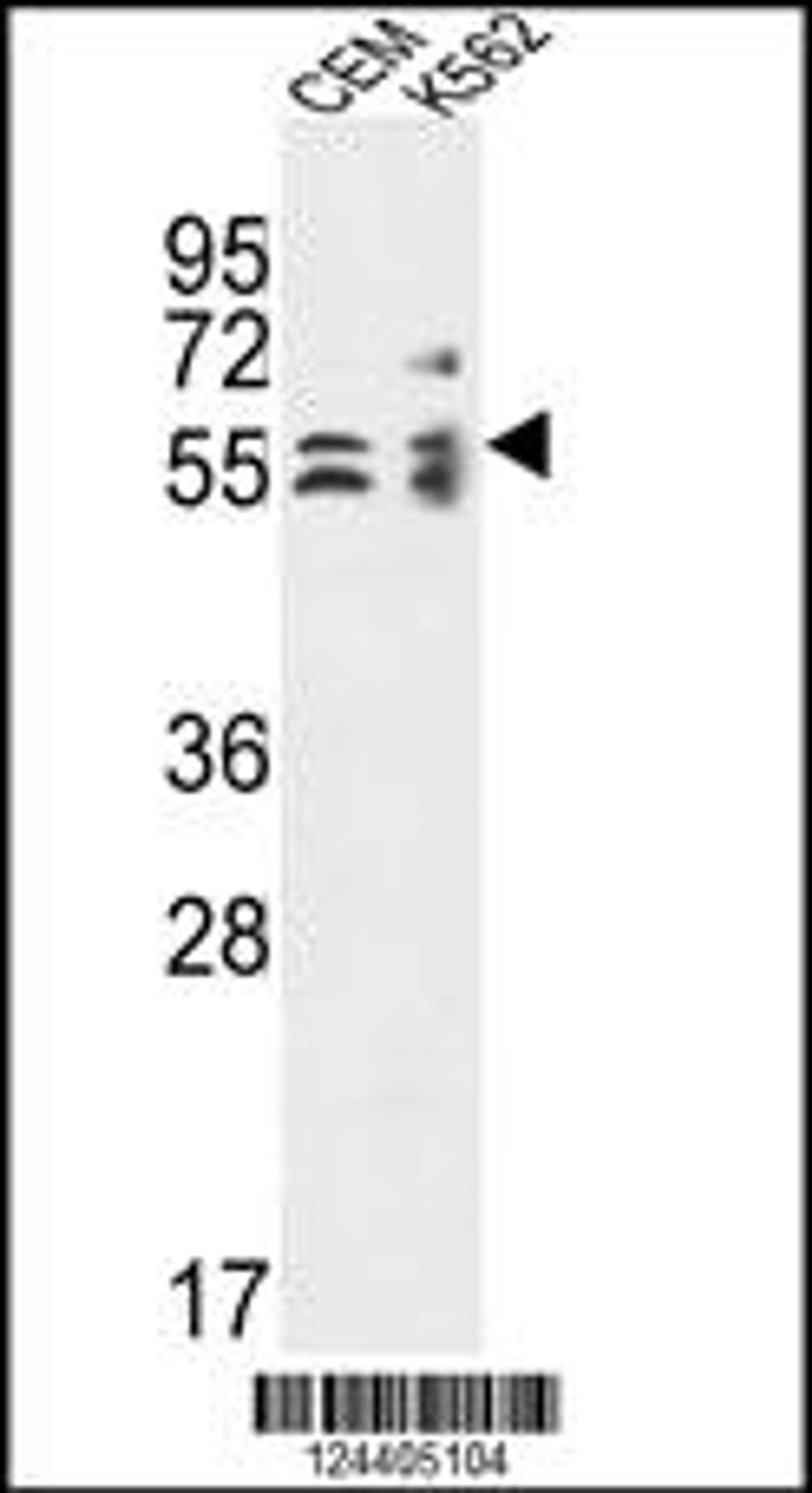 Western blot analysis in CEM,K562 cell line lysates (35ug/lane).