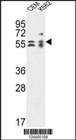 Western blot analysis in CEM,K562 cell line lysates (35ug/lane).