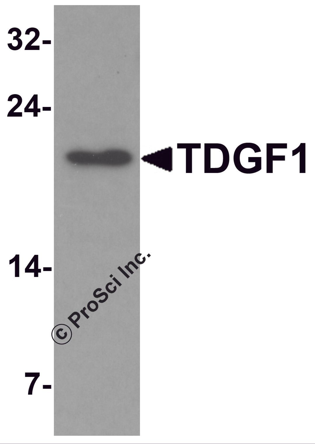 Western blot analysis of TDGF1 in 293 cell lysate with TDGF1 antibody at 1 μg/mL.
