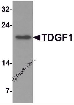 Western blot analysis of TDGF1 in 293 cell lysate with TDGF1 antibody at 1 μg/mL.