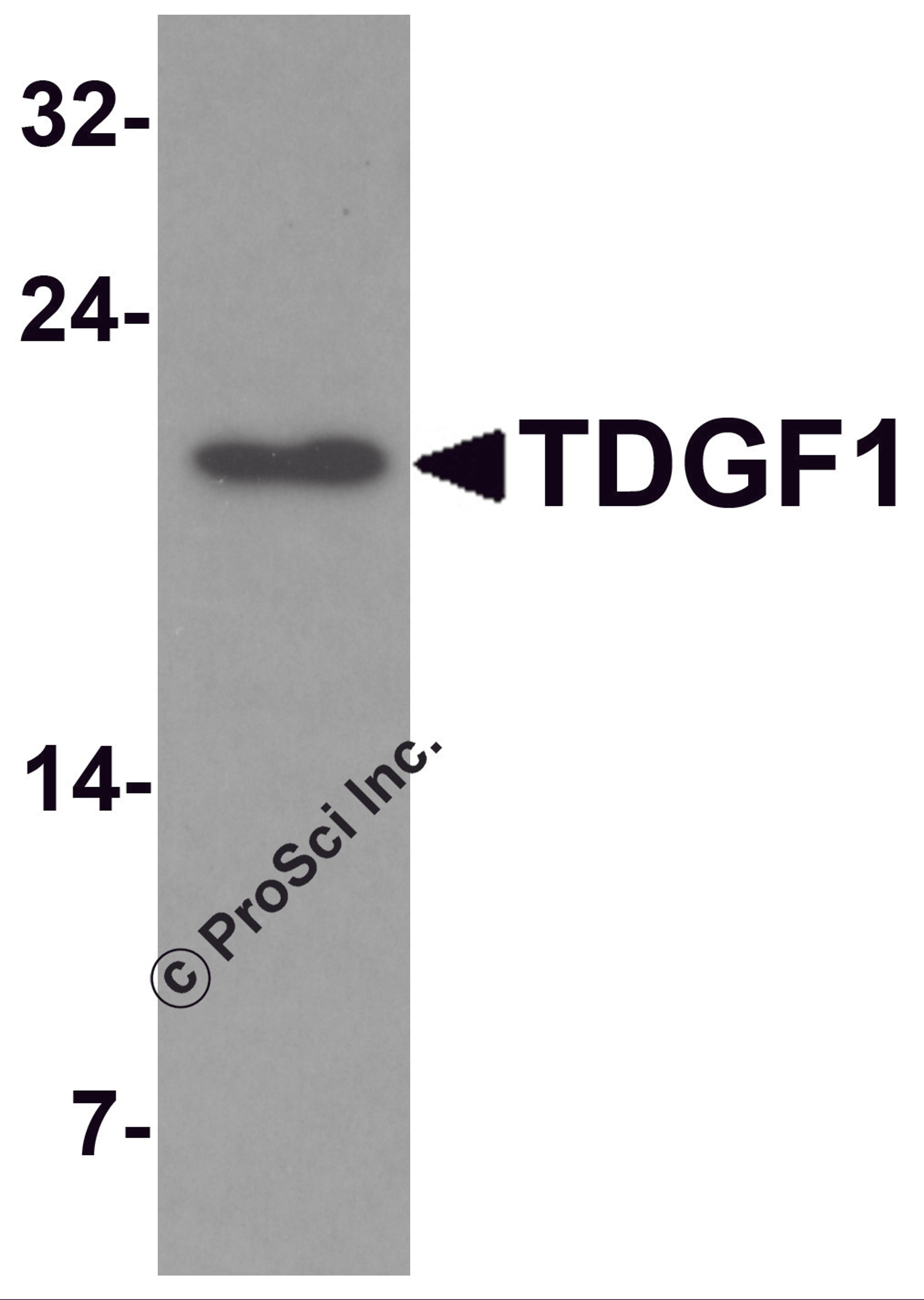 Western blot analysis of TDGF1 in 293 cell lysate with TDGF1 antibody at 1 μg/mL.